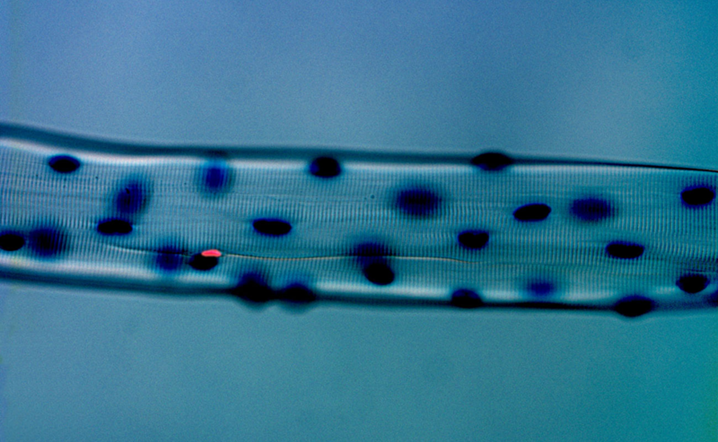 Photo of a satellite cell