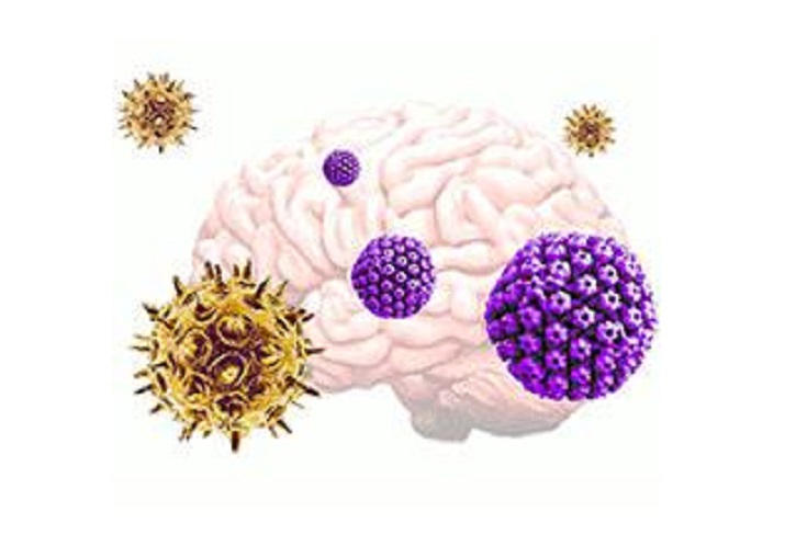 Brain illustration with varicella zoster virus (yellow) activates herpes simplex virus (purple) from dormancy, which then leads to an increase in plaque deposits and decrease in neural signaling