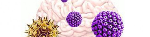 Brain illustration with varicella zoster virus (yellow) activates herpes simplex virus (purple) from dormancy, which then leads to an increase in plaque deposits and decrease in neural signaling